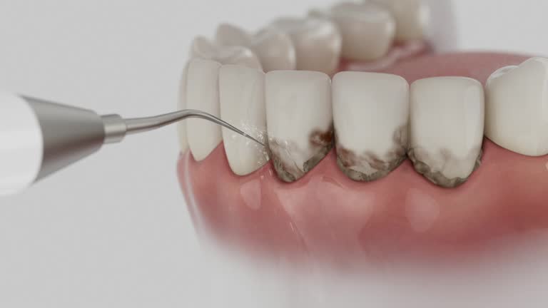 Trusted Root Canal Treatment service in Collinsville, AL - Dentist Open Now